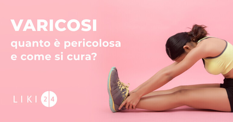 Varicosi: quanto è pericolosa e come si cura?