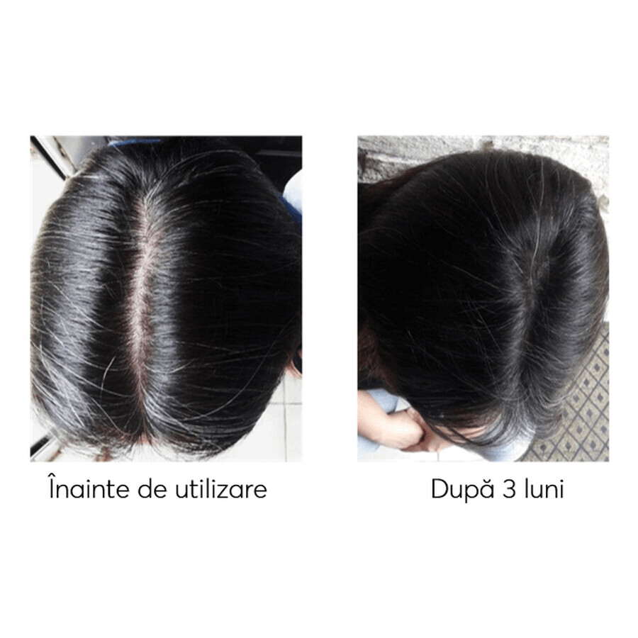Kit contro la caduta dei capelli, Ageless Clinic, 3 pezzi, Ru:t hair, 80 ml, Biocart
