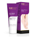 Crema per calli SheFoot, 75 ml, SheCosmetic