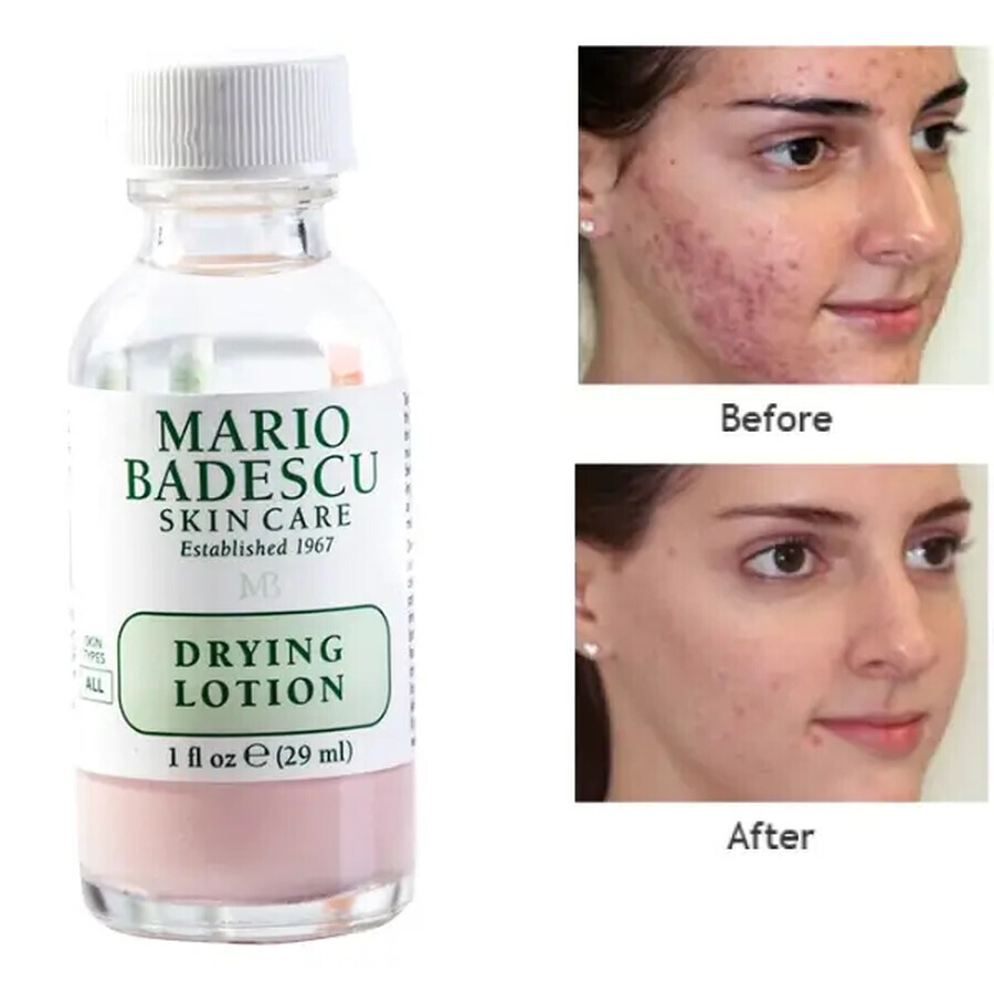 Mario Badescu Lozione essiccante - Per tutti i tipi di pelle, 29ml