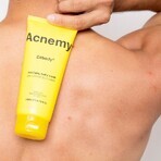 Acnemy Zitbody Gel detergente corpo 200 ml