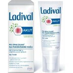 LADIVAL Akut Siero viso 1×50 ml, siero viso dopo l'esposizione al sole